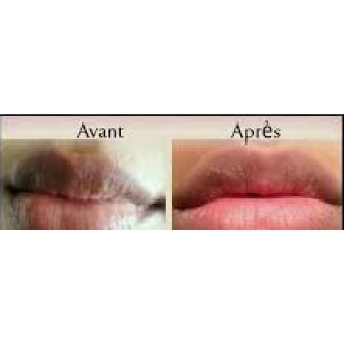 Baume Lèvre Roses Perfect Skin